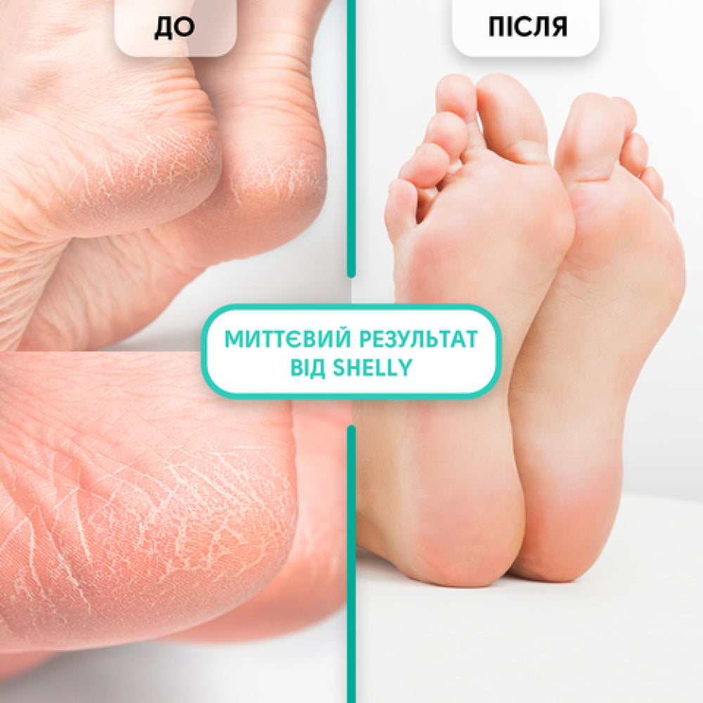 GEL-KERATOLITIC FOR REMOVAL OF CALORS AND CALVES SOFT BLADE SHELLY 200 ML