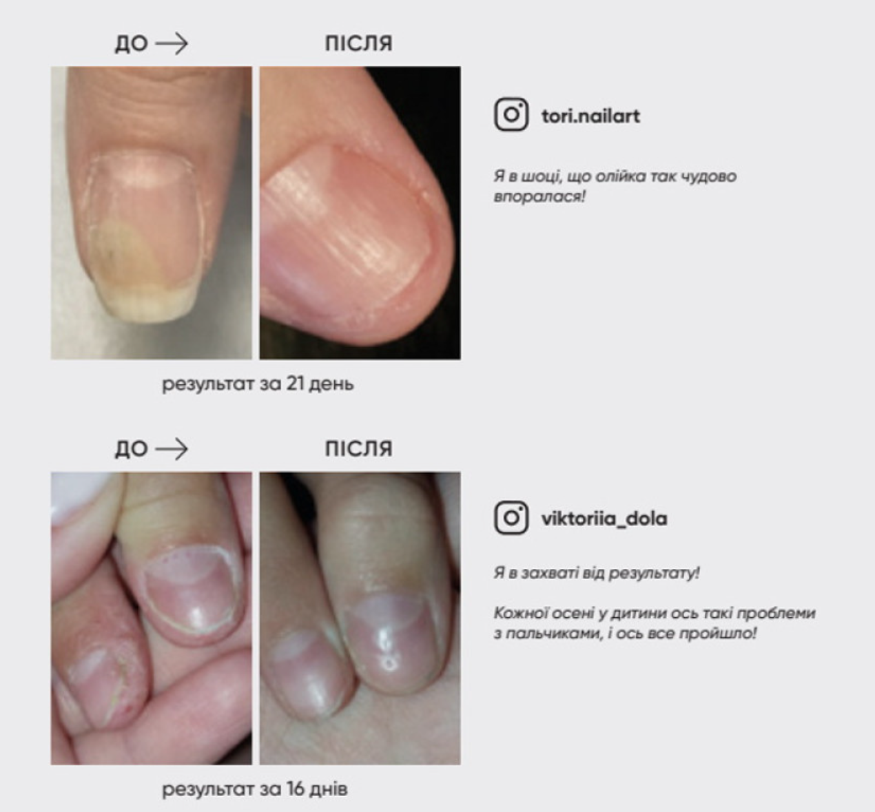 Олія від оніхолізису NAILSOFTHEDAY OniStop, 15 мл